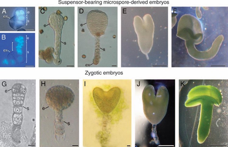 Comparación entre las distintas etapas de la embriogénesis haploide (androgénica, Figuras A-F), y la zigótica (Figuras G-K) en colza.