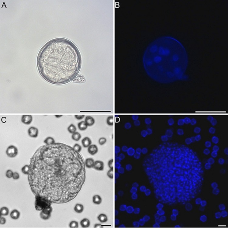 Microscopía óptica de contraste de fase y de fluorescencia.