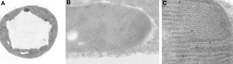 Localización ultraestructural de la proteína L1 del virus del papiloma humano.